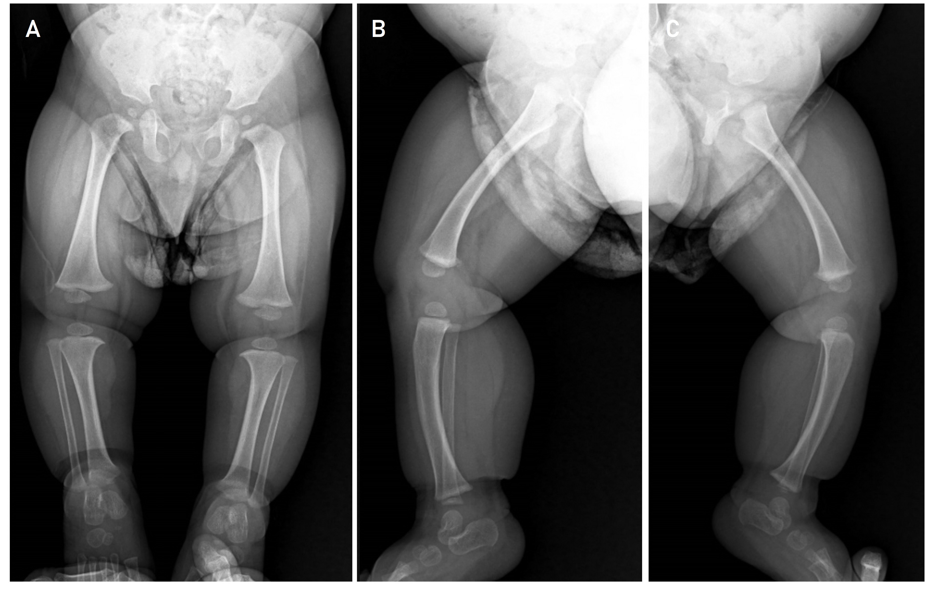 Radiological evaluation of the patient 